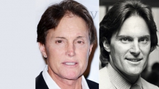 Did Bruce Jenner Get A Nose Job?
