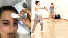 Kangana Ranaut 'Thrilled' To Have Battle Scar On Face!