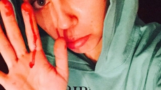 Miley Cyrus Posts A Disturbing Selfie Of Herself With Blood Dripping From Her Nose