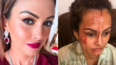 Nisha Rawal accuses Karan Mehra of having an affair, beating her