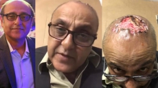 WATCH: Pakistani Actor Sajid Hasan Reveals Harrowing Case Of Hair Transplant Mishap