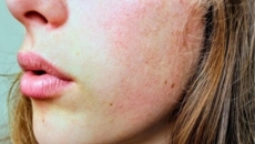 Skin slugging: Ace your winter glow