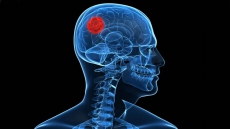 Air pollution harming brains of urban young