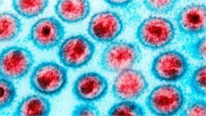 Baby ‘Functionally’ Cured of HIV Sets Milestone for Scientists