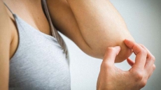 Why scratching makes an itch worse