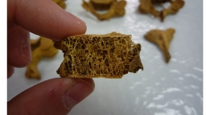 Osteoporosis From the Inside Out