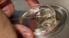 Trying For Test-tube Baby? Moms' Risks Are Rare, Include Over-stimulating Ovaries