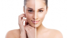 UV Rays May Damage Skin Hours After Sun Exposure