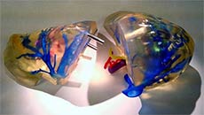 3D-printed replica for a safe liver transplant created