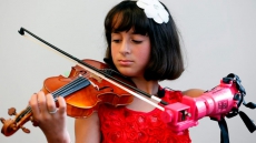 WATCH: Undergrads Build Prosthetic Arm For 10-Year-Old Violinist