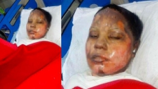 Pakistani Man Arrested For Burning Christian Woman To Death Over Refusing His Marriage Proposal