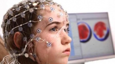 New method can detect epilepsy symptoms early in kids
