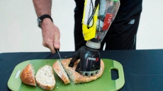 Bionic Hand System Created By SFU Team Allows Parathlete To 'Move' Fingers