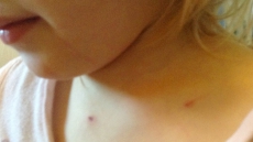 Vancouver Island Dad Punches A Cougar In The Face To Rescue His 2-Year-Old Girl From Its Jaws