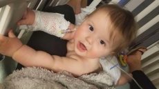 B.C. Baby Who Put Spiny Caterpillar In Mouth Recovering Well After Treatment