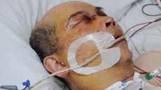 East Vancouver Man Attacked After Posting Craigslist Ad Will Never Fully Recover: Police