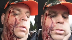 New Brunswick Restaurateur Survives After Being Shot In Face By Misfiring Rifle