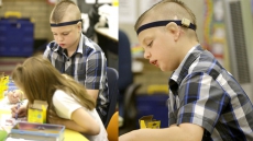 Miraculous Surgical Feat: Indian-American Doctor Gifts New Ears To A Second-Grade US Student