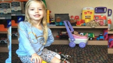 Parents Choose To Break Daughter's Leg Three Times A Day For Four Months To Avoid Amputation