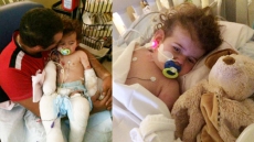 Dangerous Bacterial Disease Claims 15-Month-Old Toronto Boy's Legs; Vaccination Has Made Hib Rare