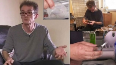 English Engineer Performs Surgery on Himself After Being Put on Waiting List