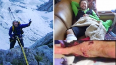 Greg Boswell, Scottish Climber Lives To Tell Tale Of Attack By Grizzly In The Canadian Rockies