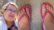 Manitoba Woman Alleges Body Shaming After Spa Refuses To Do Pedicure
