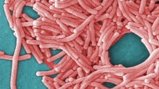 Quebec Officials Investigating As Legionnaires' Disease Claims Two Lives