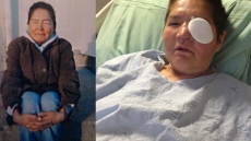 Homeless Woman Who Was Viciously Beaten Attends Attacker's Hearing