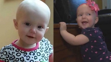 New Brunswick Toddler Who Inspired Bone Marrow Drives Dies Of Leukemia