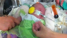 Chilliwack Baby Whose Parents Were Fighting To Treat With Cannabis Oil Dies In Hospital