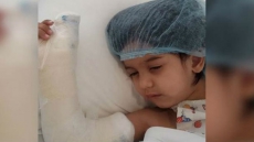 3-Year-Old’s Thumb Amputated After Injury At Daycare Centre, Owner Booked