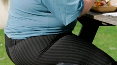 Even doctors struggle to identify obesity