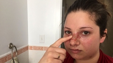 Assault Charge Laid In Truno, Nova Scotia After Woman Allegedly Burned With Hot Pizza