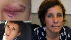 No Jail Time For Man Who Assaulted Abbotsford Nurse