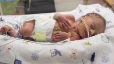 Premature babies at higher risk of brain disorders