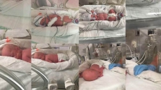 Astronomical Odds: Naturally Conceived Identical Quads Born To Alberta Couple