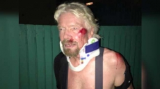 'Thought I Was Going To Die': Richard Branson On Horrific Bike Crash