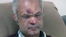 Hate Crime: Indian American Man In New Jersey Attacked Viciously, Community Calls For Zero Tolerance