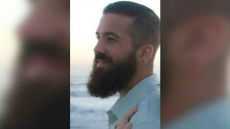 US Man Tries To Kiss Rattlesnake, Gets Bitten On Tongue