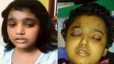 WATCH: 13-Yr-old Indian Girl Begs Father For Cancer Treatment, Gets Thrown Out, Dies