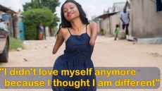 WATCH: Born Without Limbs, This 24-Year-Old Motivational Speaker And Beauty Blogger Spreads Hope