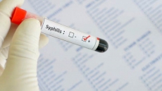 New UBC Study Finds HIV Treatment Could Contribute To Syphilis Outbreak