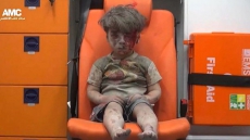 How Syrian Boy With Burnt Face Became Propaganda Icon