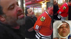 Canadian Man In Video Of Scuffle With Chicago Policeman Sues