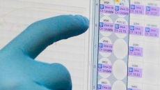 Woman Found To Spread Zika Through Sex For 1st Time