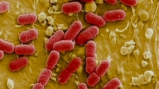 Alberta: 100 People Have Gotten Ill From E. Coli Linked To Raw Pork Products