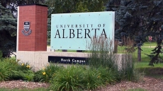 University Of Alberta Professor Announces Breakthrough On Liver Disease