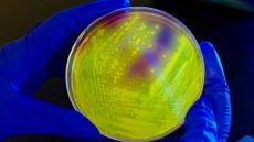 Heavy Use Of Antibiotics In Nursing Homes Equates To Risk For Residents: Study