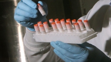 Former CFIA researcher pleads guilty in attempted bacteria-smuggling case